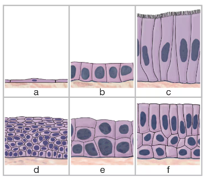 Illustration of six types of epithelial tissue cells labeled a to f, showing various shapes and arrangements.