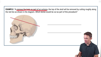 The Skull Example 1