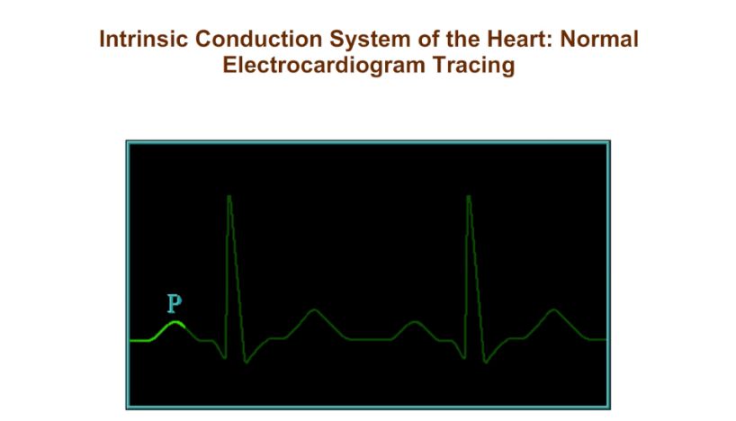 Intrinsic Conduction System of the Heart