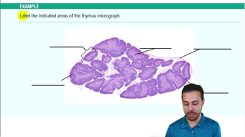 Primary Lymphoid Organs Example 2