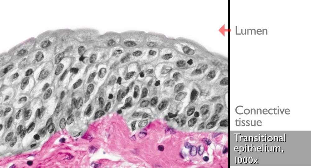 Microscopic Appearance of Transitional Epithelium