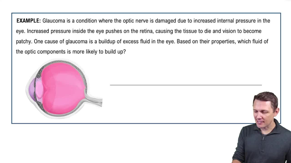 Optic Components of the Eyeball Example 1