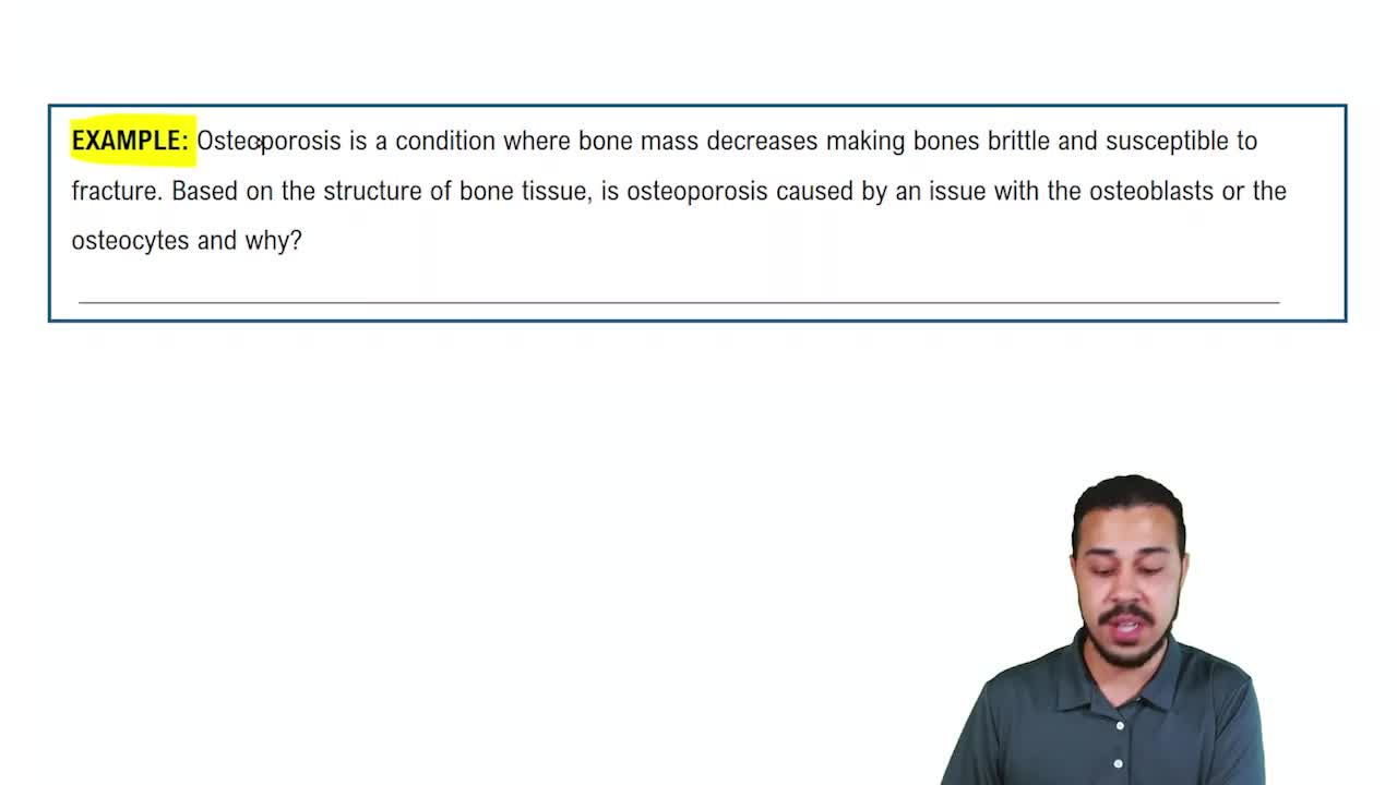 Specialized Connective Tissue: Bone Example 1