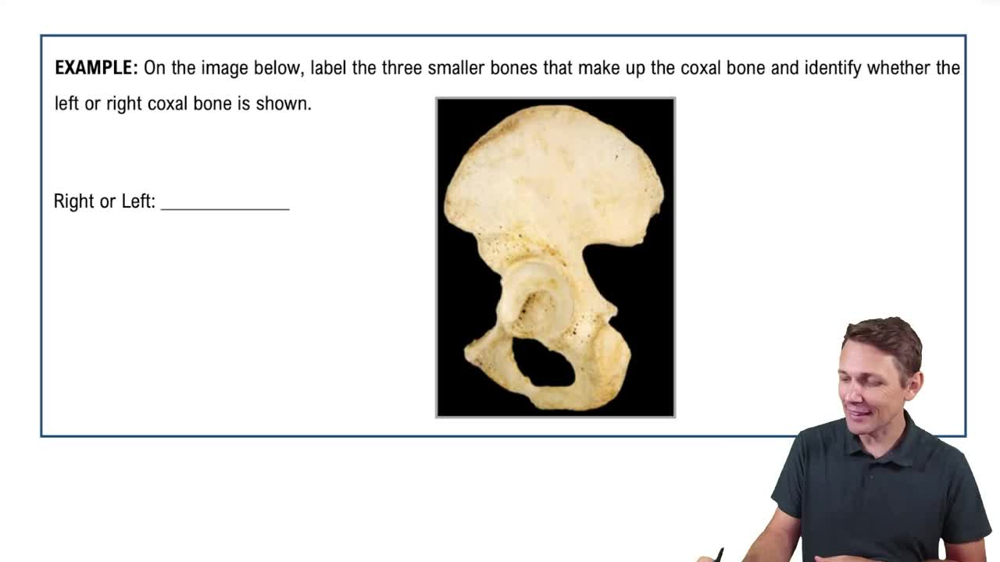 The Pelvic Girdle Example 1