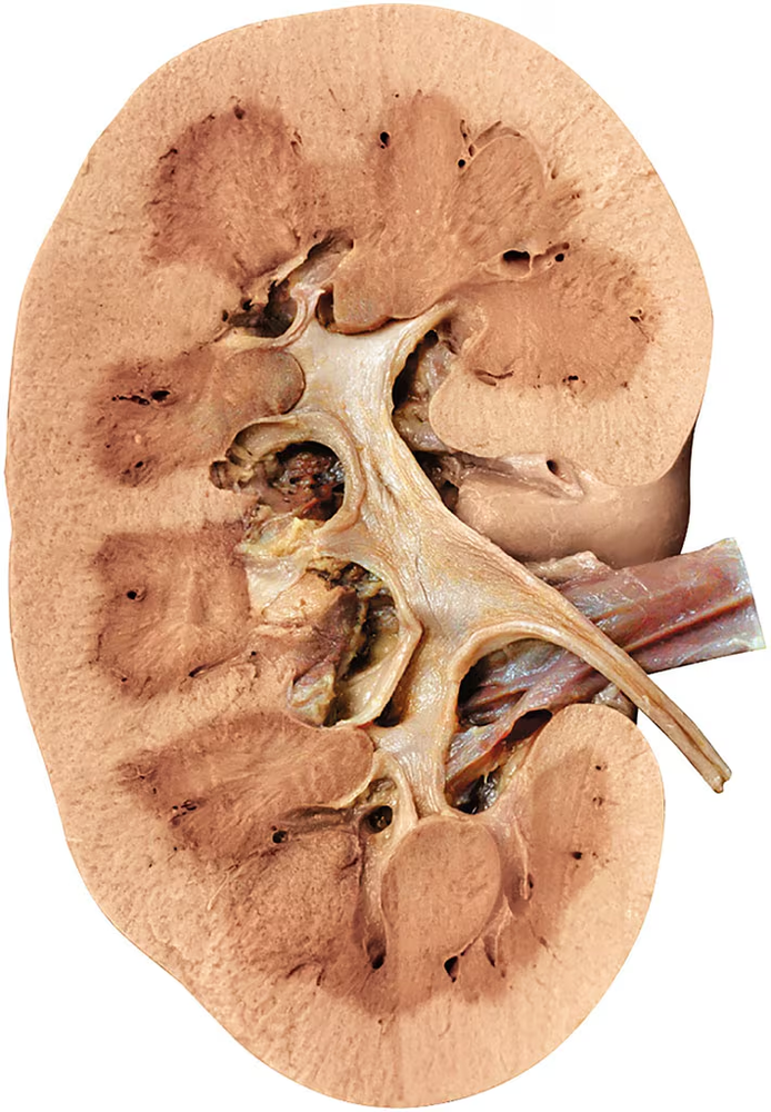 Labeled diagram of a kidney showing the cortex, medulla, medullary pyramids, renal columns, and pelvis.