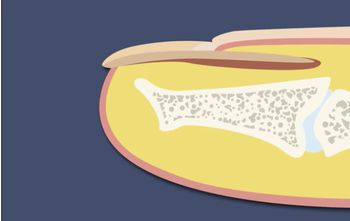 Integumentary System: your nails