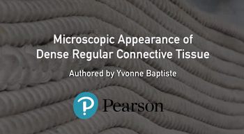 Microscopic appearance of dense regular connective tissue