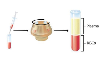 Hematocrit