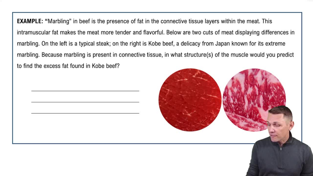 Structure of a Skeletal Muscle Example 1