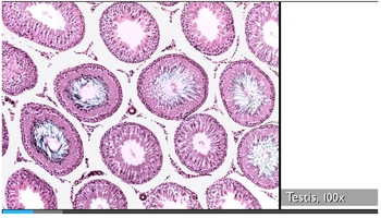 Microscopic appearance of testes
