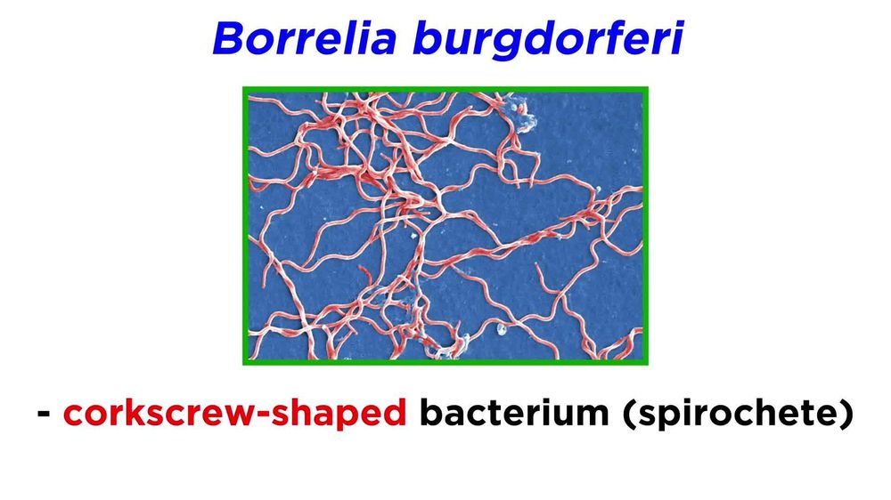 Lyme Disease Borrelia burgdorferi