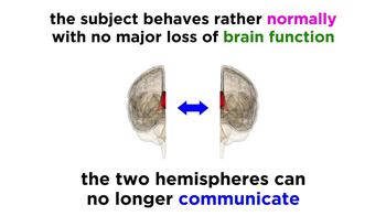 Brain Lateralization The Split Brain
