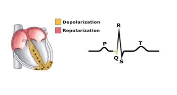ECG