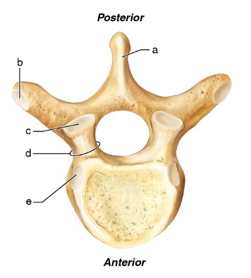 Thoracic vertebra showing labeled parts where ribs articulate, including transverse process and costal facets.