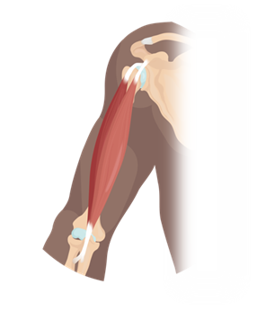 Illustration of an arm muscle showing fascicle arrangement connecting shoulder to elbow bones.
