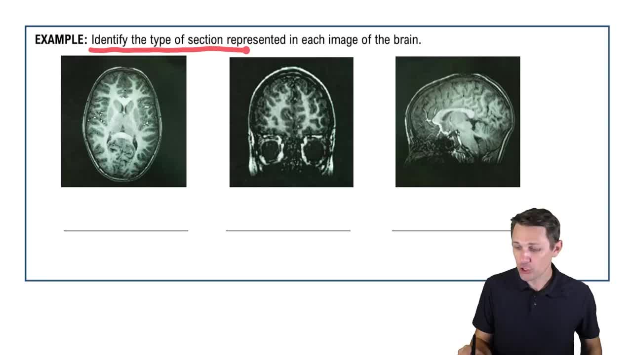 Anatomical Planes & Sections Example 2