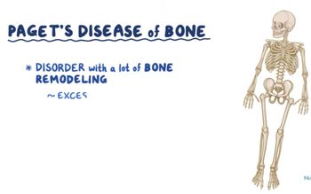 Paget Disease: Osmosis