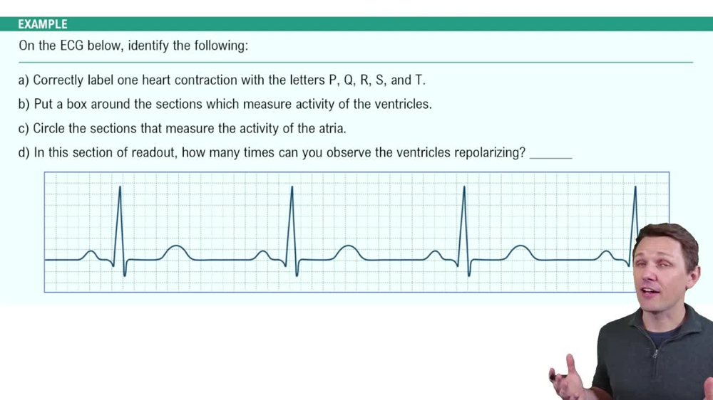 Electrocardiogram (ECG) Example 1