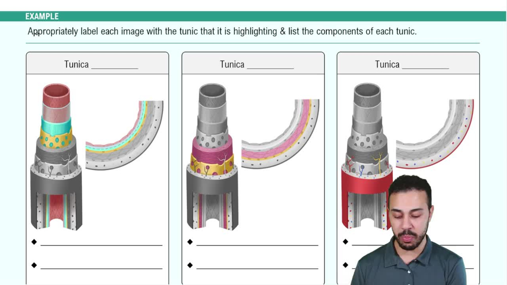 General Blood Vessel Structure Example 1