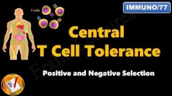 Central B cell Tolerance : Receptor Editing, Clonal Deletion and Anergy
