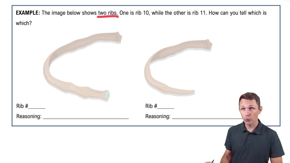 The Thoracic Cage Example 1