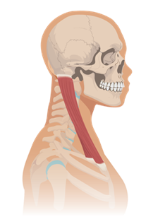 Side view illustration of a human neck showing the sternocleidomastoid muscle and surrounding skeletal structures.