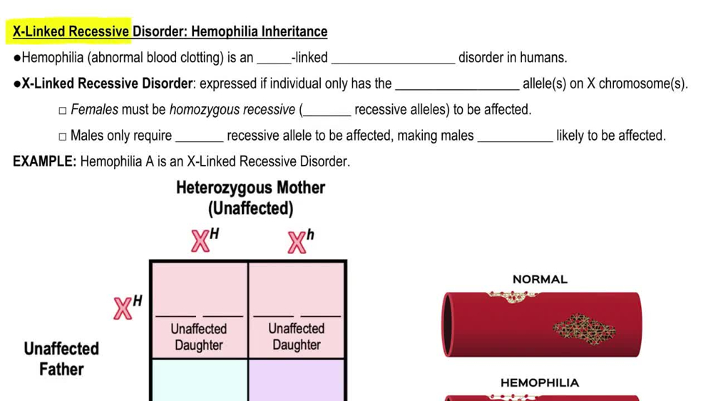 X-Linked Recessive Disorder: Hemophilia Inheritance