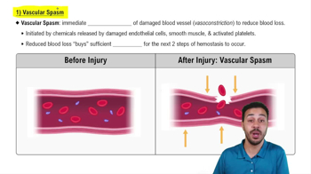 Vascular Spasm