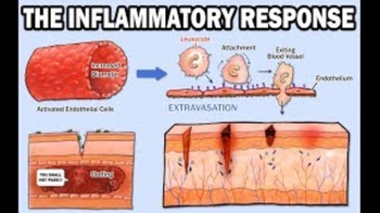 The Inflammatory Response