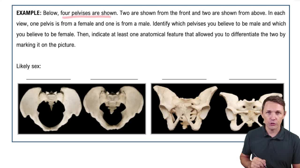 The Pelvic Girdle Example 2