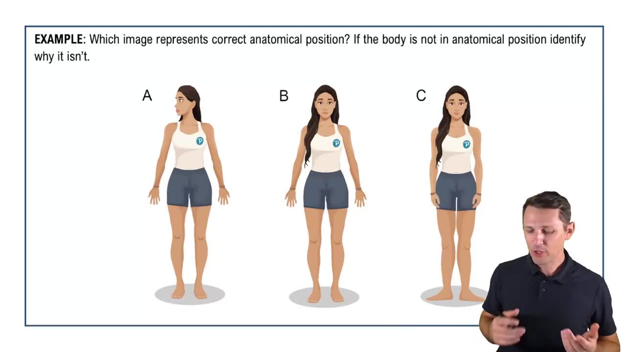 Anatomical Position Example 1