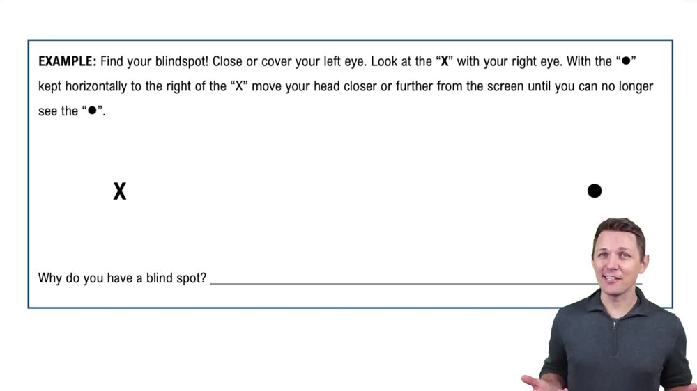Inner Layer of the Eyeball Example 3