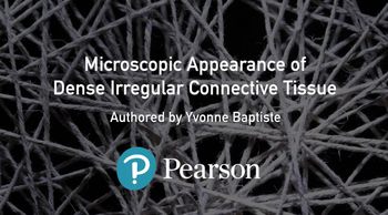 Microscopic appearance of dense irregular connective tissue