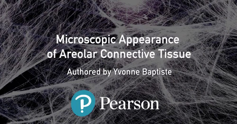 Microscopic appearance of areolar connective tissue