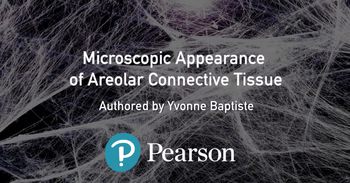 Microscopic appearance of areolar connective tissue