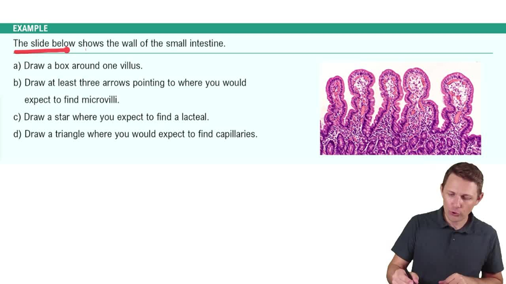 Small Intestine Example 2