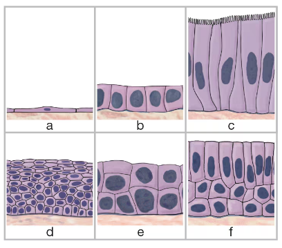 Illustration of six types of epithelial tissue cells labeled a to f, showing various shapes and layers.