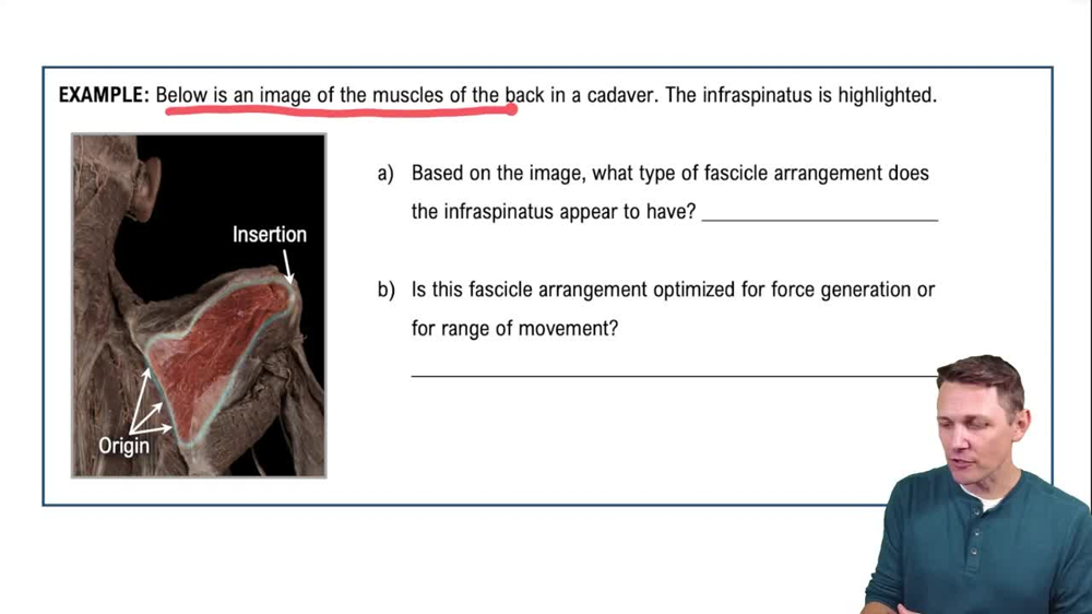 Fascicle Arrangements Example 1