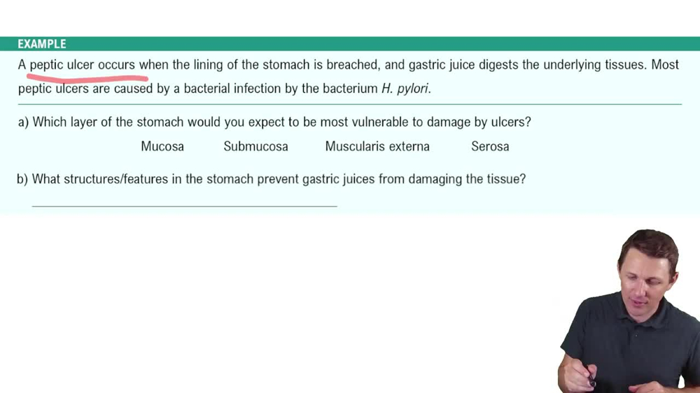 The Stomach Example 2