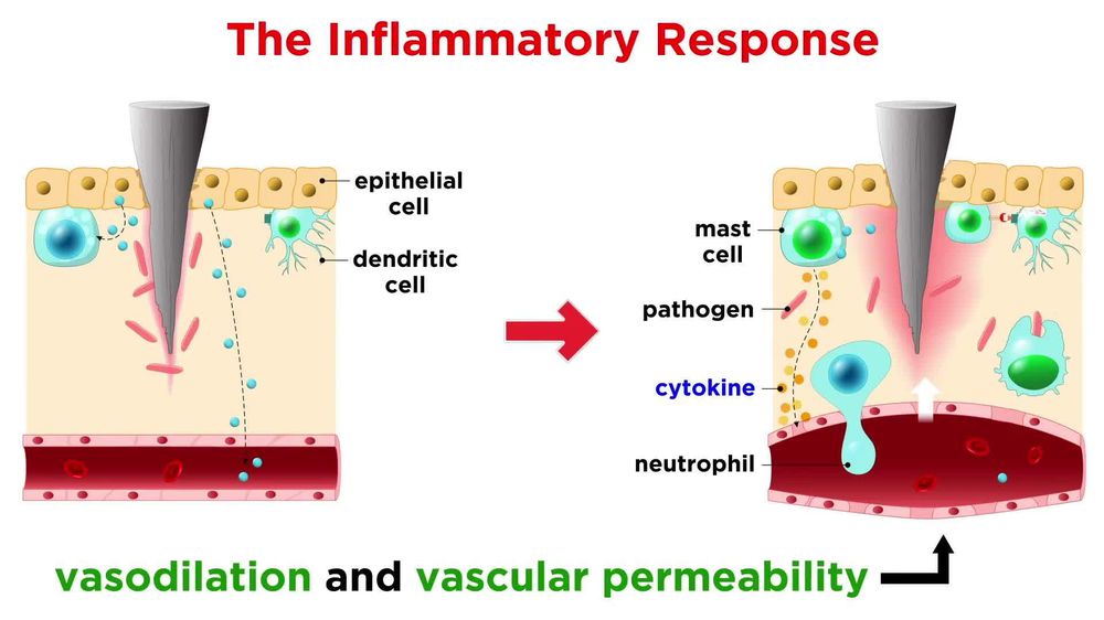 The Immune System: Innate Defenses and Adaptive Defenses