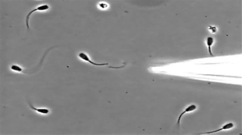 Short Video: Flagellum in Sperm