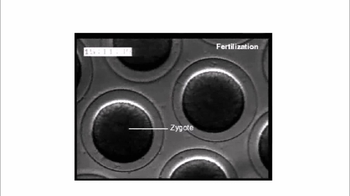 Short Video: Sea Urchin Fertilization and Cleavage