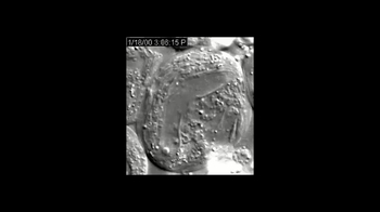 Short Video: Meiosis Sperm