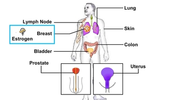 Animation: Causes of Cancer