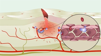 Animation: Overview of the Inflammatory Response