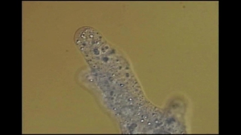 Short Video: Amoeba Pseudopodia