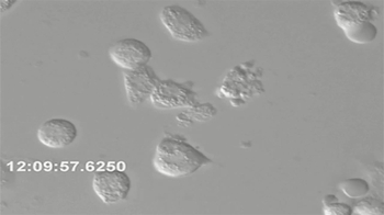 Short Video: Phosphate induced Apoptosis