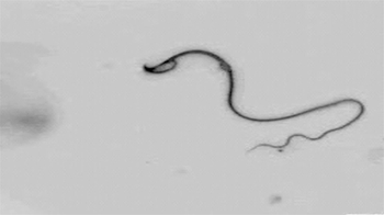 Short Video: Sperm Flagellum