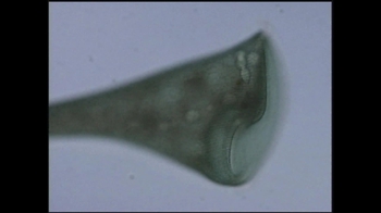 Short Video: Stentor Ciliate Movement