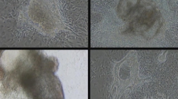 HHMI BioInteractive: Cultured Embryonic Stem Cells